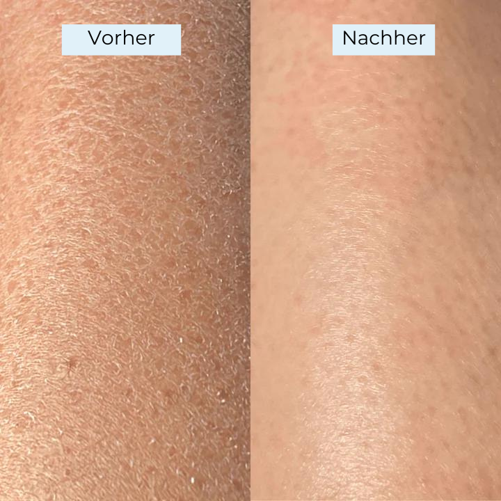 Glowy – die Nummer 1 für strahlende, glatte Haut, der tausende vertrauen