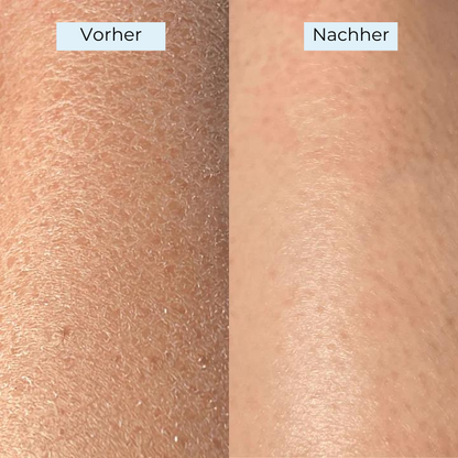 Glowy – die Nummer 1 für strahlende, glatte Haut, der tausende vertrauen